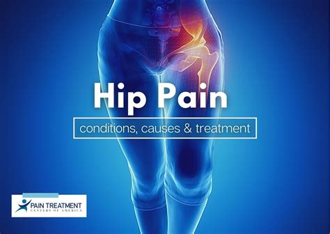 Hip pain .